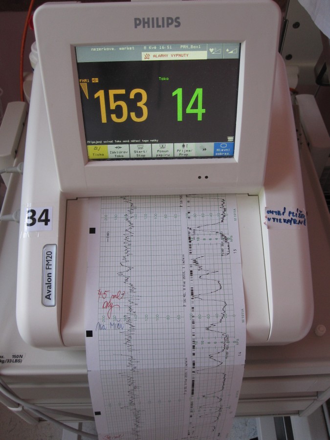 Vlevo srdce Matýska, vpravo bolesti Maky